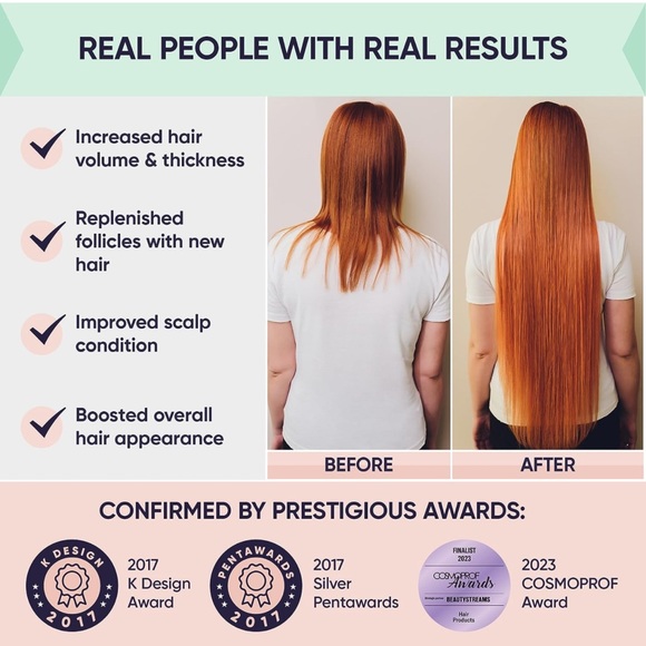 Moerie Ultimate Hair Growth Spray Designed to Strengthen & Stop Hair Loss - Picture 3 of 6